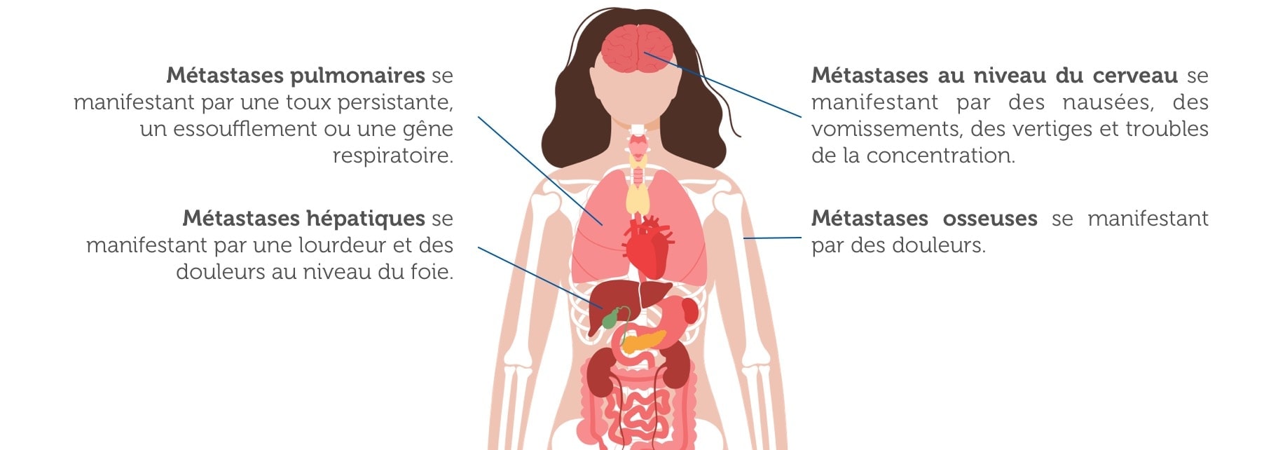 Progression de la maladie