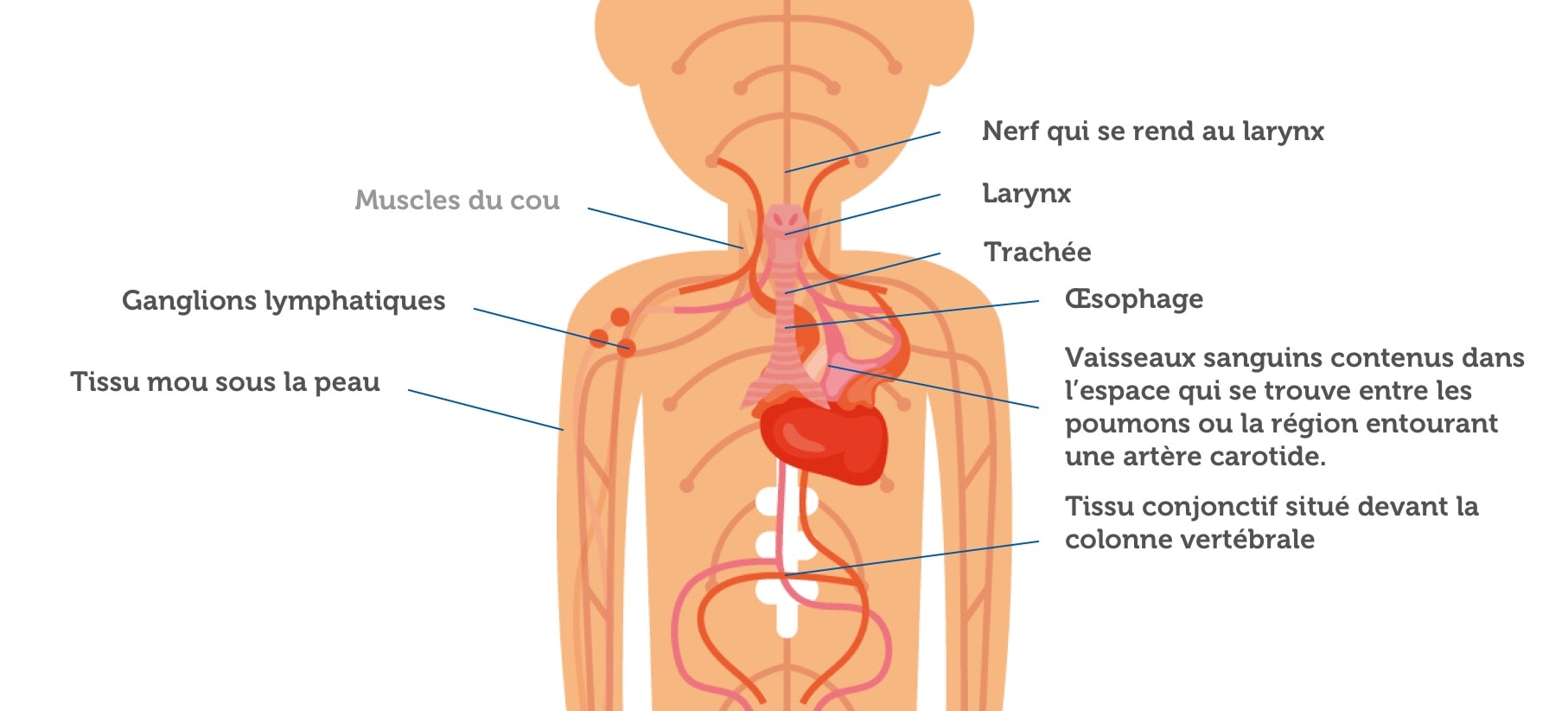 Quels sont les tissus ou organes voisins où peut s’être propagé votre cancer de la thyroïde ?